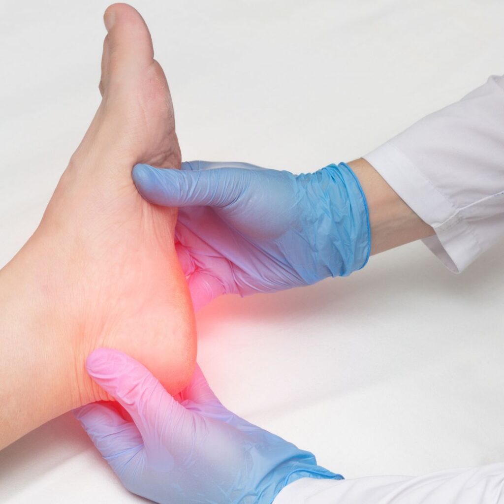 Fascitis Plantar Tratamiento Podólogo Valencia
